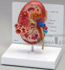 Kidney w Pathologie​s Anatomical Model